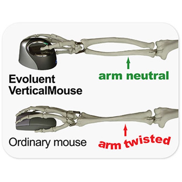 Comment choisir une souris ergonomique ? - Posture Assise au travail
